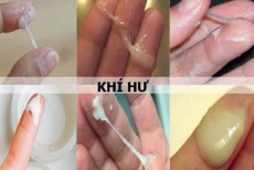 Khí hư là gì? Cách phân loại và nhận biết các dấu hiệu thường gặp 