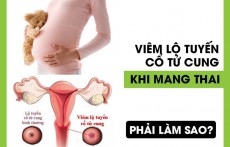 Bị viêm lộ tuyến cổ tử cung khi mang thai có làm sao không?